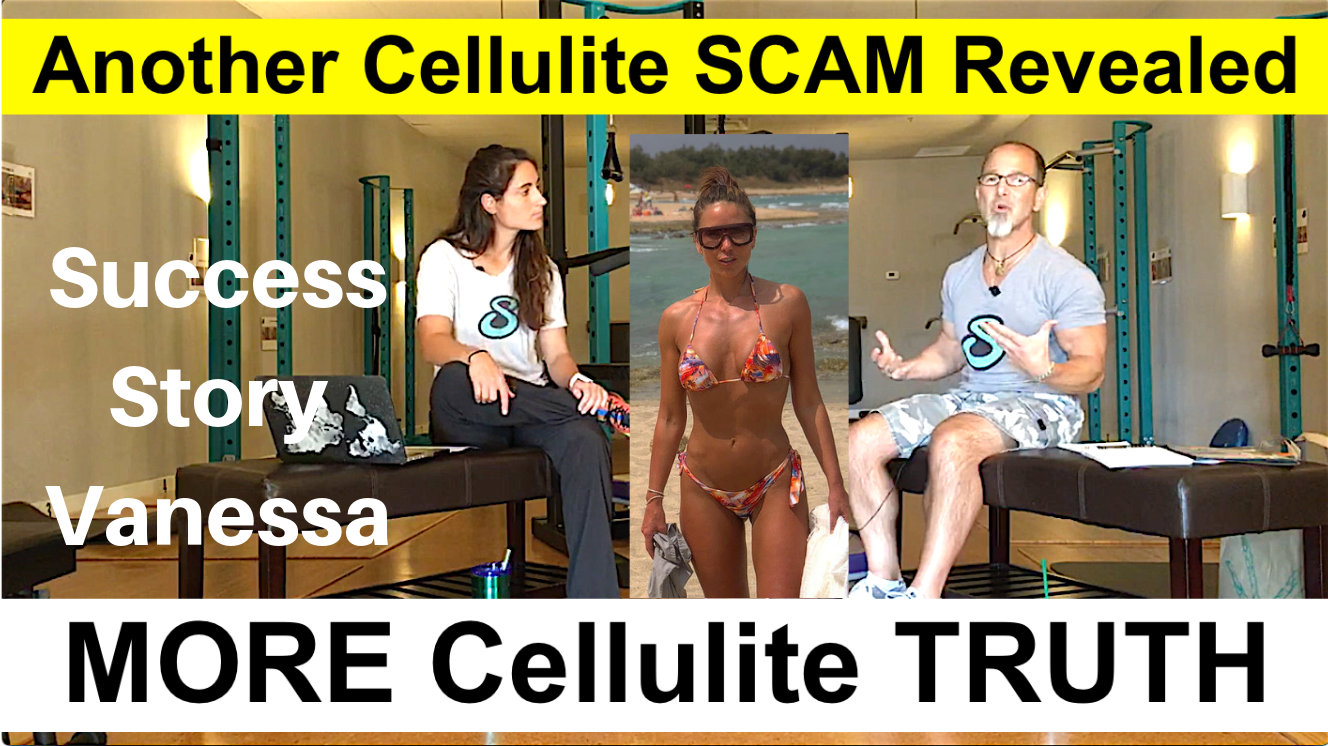 What Is Cellulite? Old Cellulite Scam Exposed and a New Cellulite Success Story